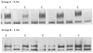 Gelelektrophorese MHC